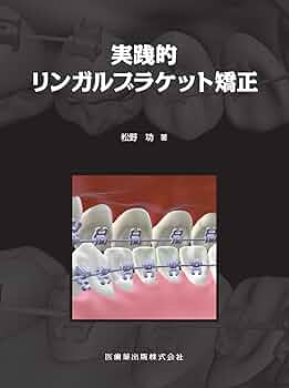 定価16000+税　リンガルブラケット矯正治療法 実践的リンガルブラケット矯正 | 松野 功 |本 | 通販 | Amazon